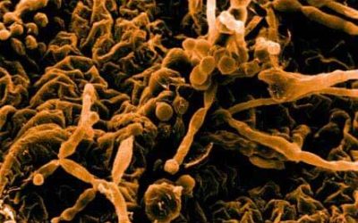 Immune Response to Mold, Common Problems, and Cleanup